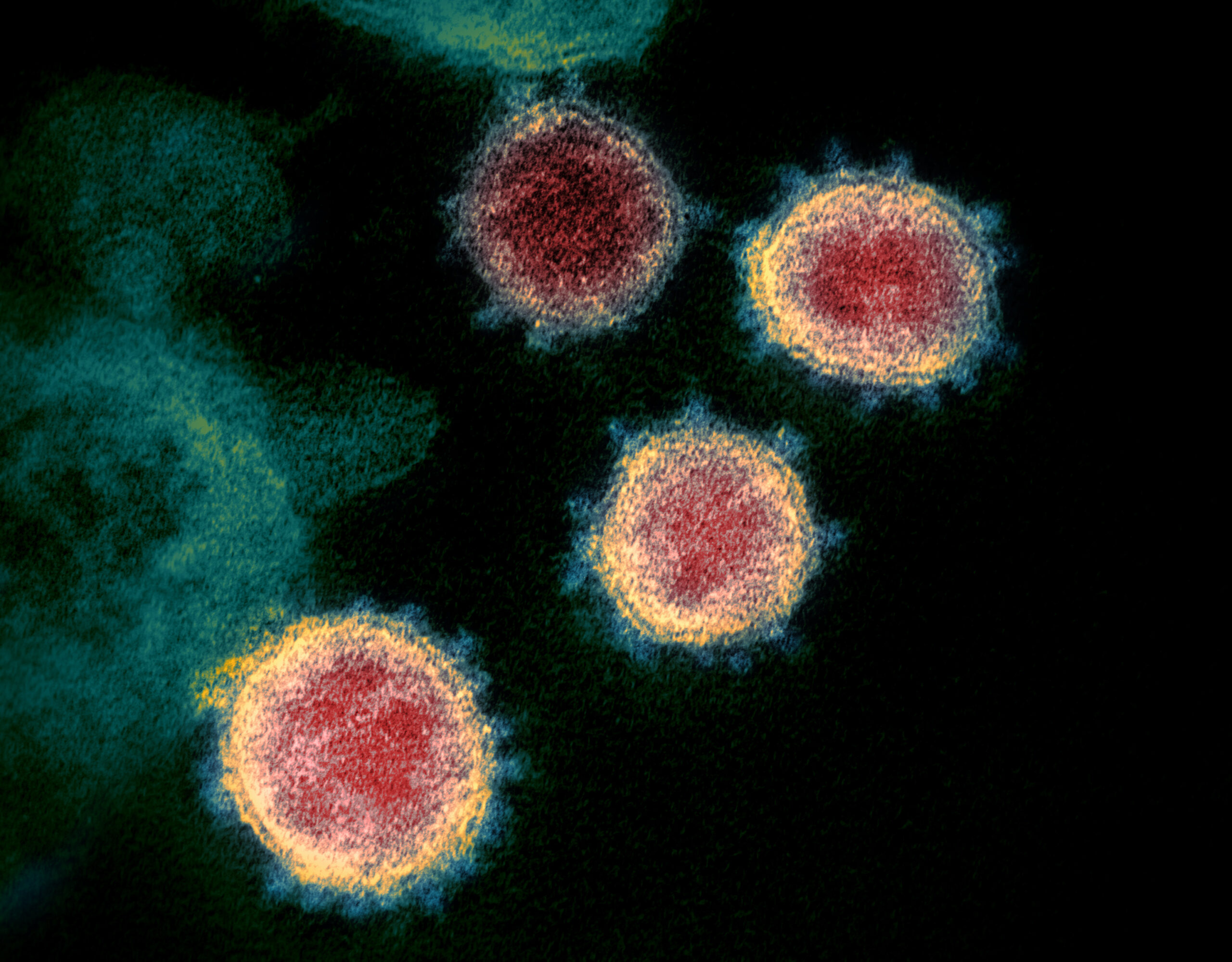 1. Introduction to Viruses (image credits: wikimedia)